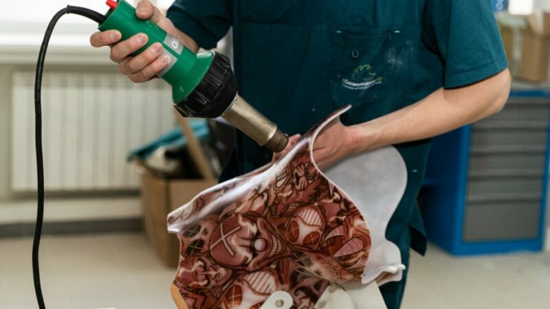 Модная инклюзия: как протезы и корсеты с рисунком становятся частью жизни и стиля