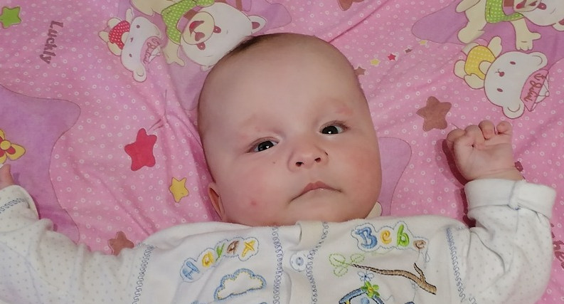 Пятимесячной Милане Артемовой необходимо 149 тыс. рублей на лечение по методу Понсети
